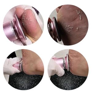 Hướng dẫn sử dụng máy chà gót chân